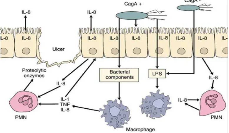 Gambar 2.4. Imunopatogenesis Infeksi H.pylori21 