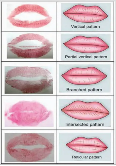 Gambar 1 . Cheiloscopy
