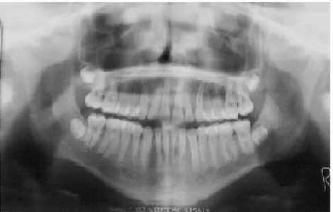 Gambar 4. Radiografi Dental