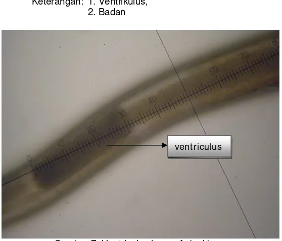 Gambar 7. Ventriculus larva   Keterangan : Ventriculus nampak jelas di bawah mikroskop, dengan pembesaran  40x40 Anisakis sp  