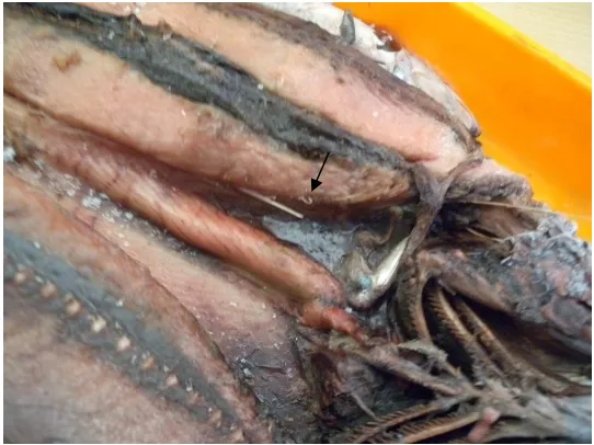 Gambar 11. Larva Anisakis yang terdapat pada Hati Ikan cakalang (K. pelamis) 