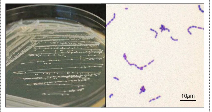 Gambar 1. Morfologi Streptococcus mutans secara makroskopis dan mikroskopis.24 