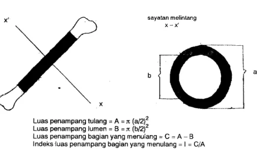 Gambar 2  Cara menentukan  luas penampang  bagian yang menulanS  (C), luas penampang tulang (A), luas penampang  lumen (B) dan indeks luas penampang  bagian yang menulang (l)