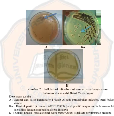 Gambar 2. Hasil isolasi mikroba dari sampel jamu kunyit asam  