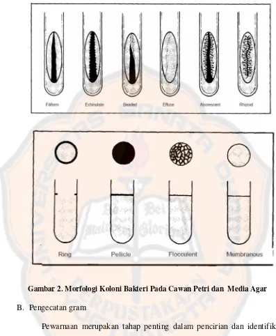 Gambar 2. Morfologi Koloni Bakteri Pada Cawan Petri dan  Media Agar  