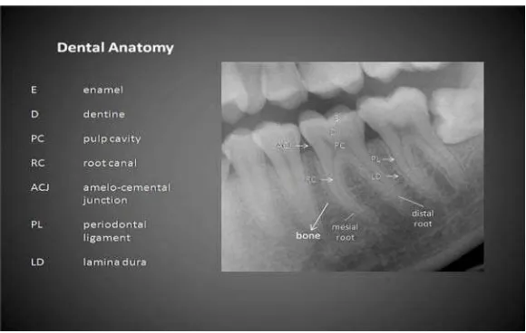 Gambar 8. Gambar anatomi normal radiografi gigi dan jaringan sekitarnya17