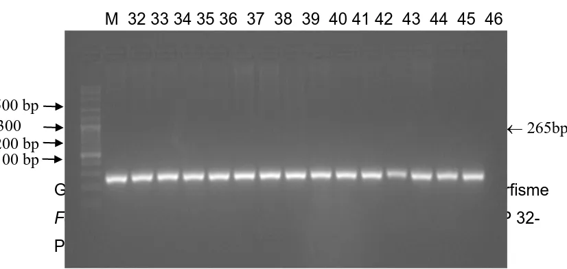Gambar 4.1. Foto elektroforesis produk PCR gen RVD polimorfisme 