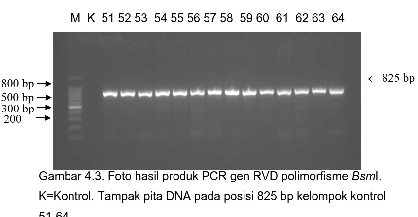 Gambar 4.3. Foto hasil produk PCR gen RVD polimorfisme BsmI. 