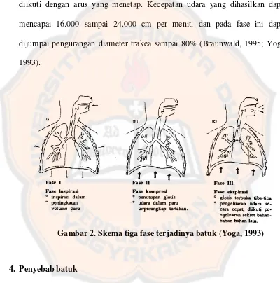 Gambar 2. Skema tiga fase terjadinya batuk (Yoga, 1993) 