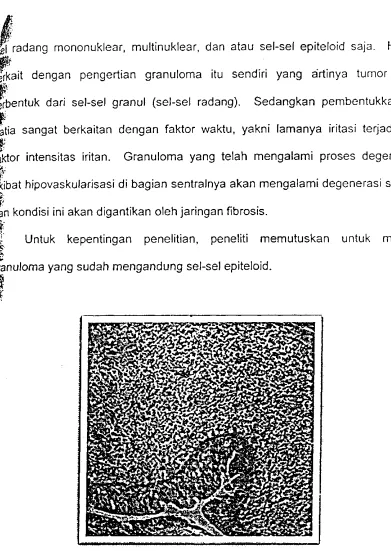 gambar 3.3. Tampak kumpulan sel-sel radang yang disebut granuloma pada irisan jaringan 