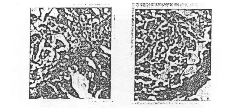 Gambar 3.7. Panah merah pada gambar A adalah sel datia, tampak sel besar dan sitoplasma 