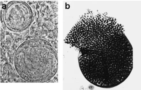 Gambar 8. Pengecatan fungi menunjukkan spherule C. immitis di jaringan (a). Lepasnya endospora (b).6 