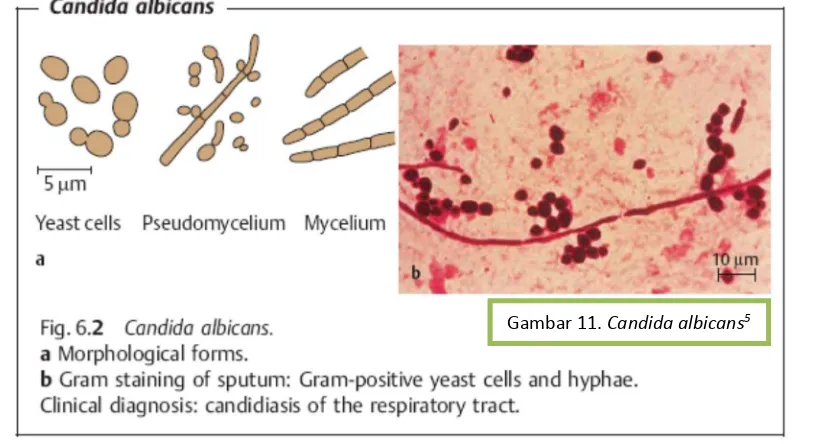 Gambar 11. Candida albicans5 