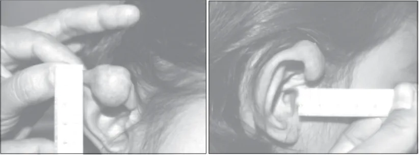 FIGURE 1. Preoperative Condition