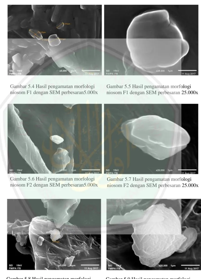 Gambar 5.4 Hasil pengamatan morfologi  niosom F1 dengan SEM perbesaran5.000x 