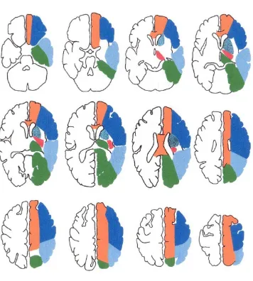 Gambar 4. Vaskularisasi Otak Dikutip dari : Jichici D., Lutsep H. 2013. Anterior Circulation Stroke