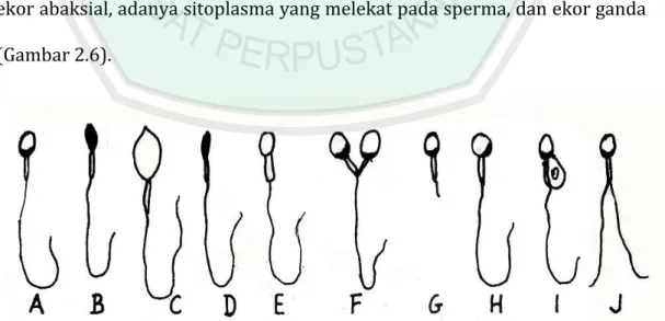 Gambar  2.6  Bentuk  spermatozoa  yang  abnormal:  (A)  sperma  normal;  (B)  kepala  gepeng;  (C)  kepala  besar;  (D)  kepala  kecil;  (E)  bagian 