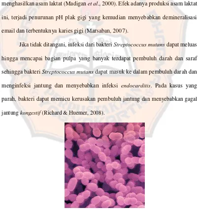 Gambar 1.  Bakteri Streptococcus mutans (Casey & Jesse, 2010)
