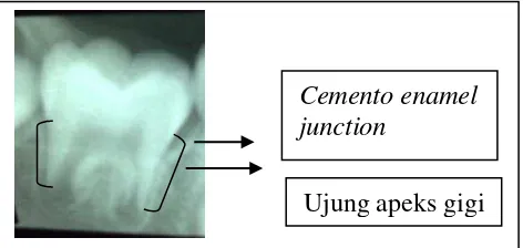 Gambar 8. Cara pengukuran panjang akar molar  