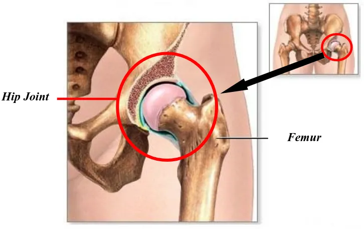 Gambar 1.1. Sambungan hip (hip joint) pada manusia [1]. 