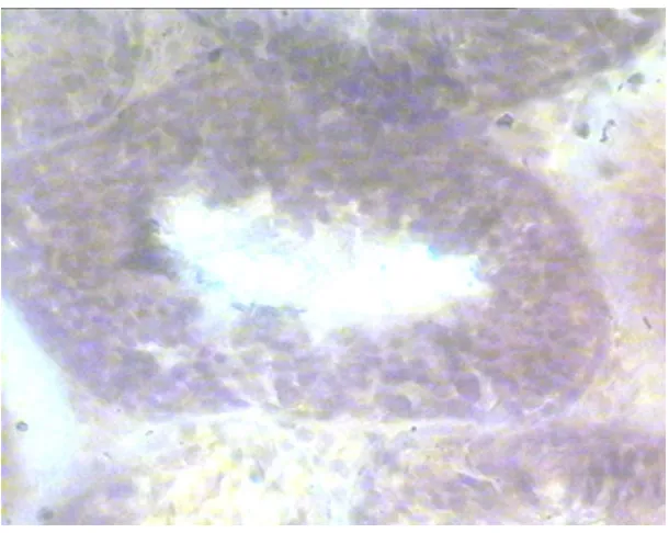 Gambar 3. Tubulus seminiferus pada kelompok vitamin Edosis 0,02 mg/g BB/hari
