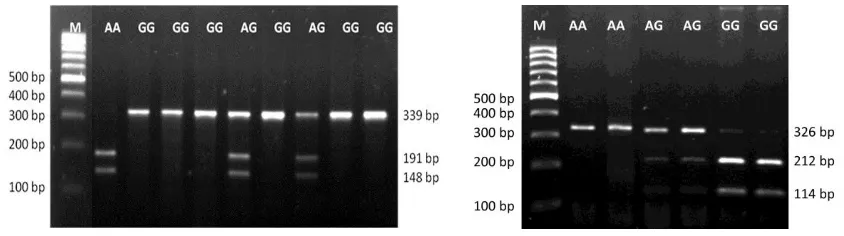 Figure 3. Visualization of GH (left) and GHR (right) fragment genes amplification in 1.5% agarose gel