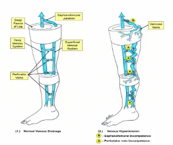 Gambar 1. Anatomi susunan vena tungkai bawah 