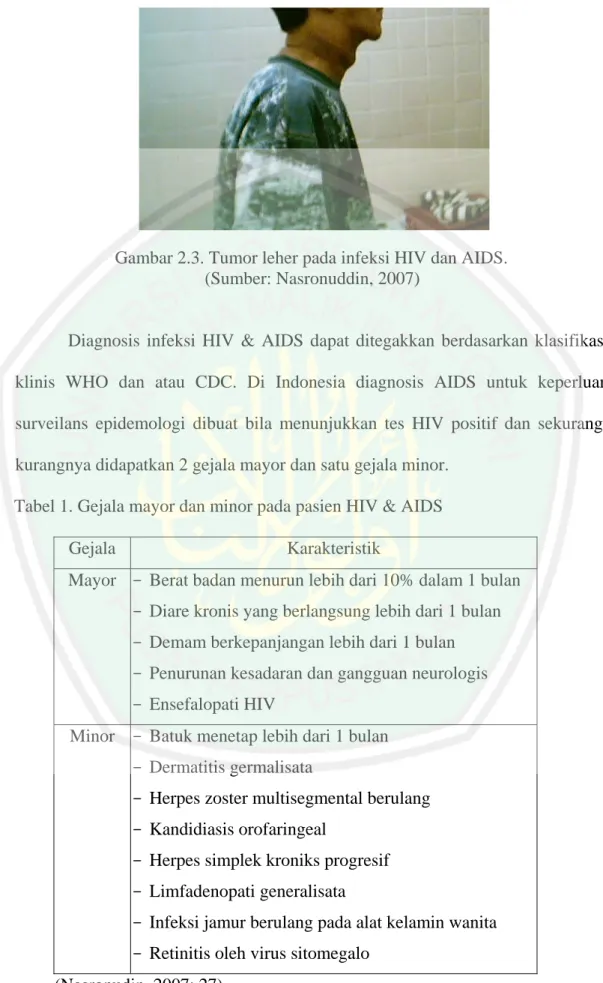 Gambar 2.3. Tumor leher pada infeksi HIV dan AIDS. 