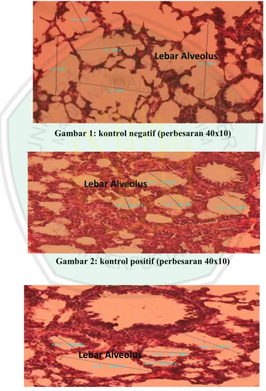 Gambar 1: kontrol negatif (perbesaran 40x10)  