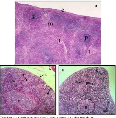 Gambar 2.6 Gambaran HistologiLimpa Normal (A) dan Rusak (B). Keterangan: (k/c) kapsula, (t) trabekula, (m/pm) pulpa merah, (p/fl)pulpa putih/folikel limfoid, (m) megakaryosit, (d) deplesi folikel limfoid, (sr) infiltarsi sel radang, (pr) deposisi protein r