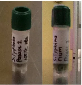 Gambar 2. (A) Blank disc; (B) Disc baku Kloramfenikol (30µg/disc)  