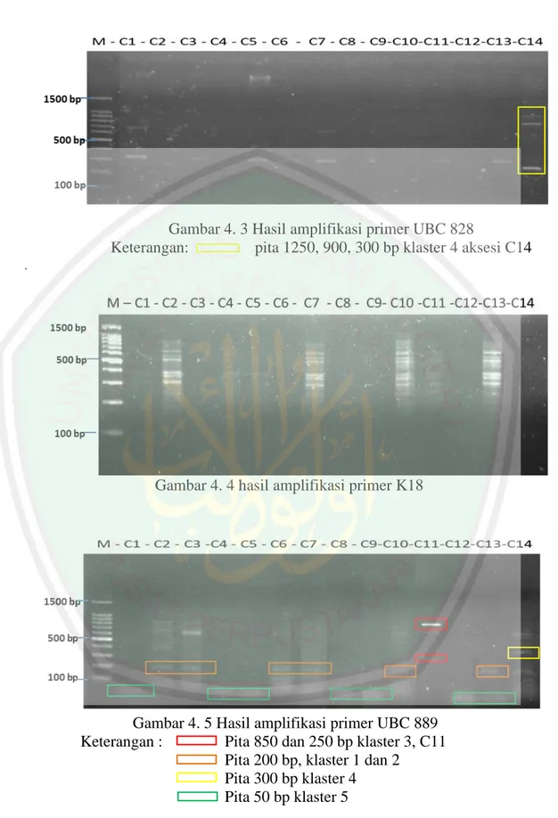 Gambar 4. 4 hasil amplifikasi primer K18 