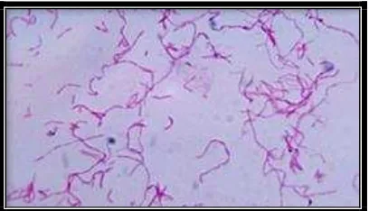 Gambar 3. Fusobacteria nucleatum.23