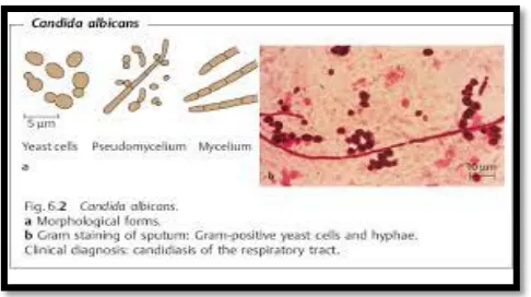 Gambar 1. Morfologi Candida albicans22 