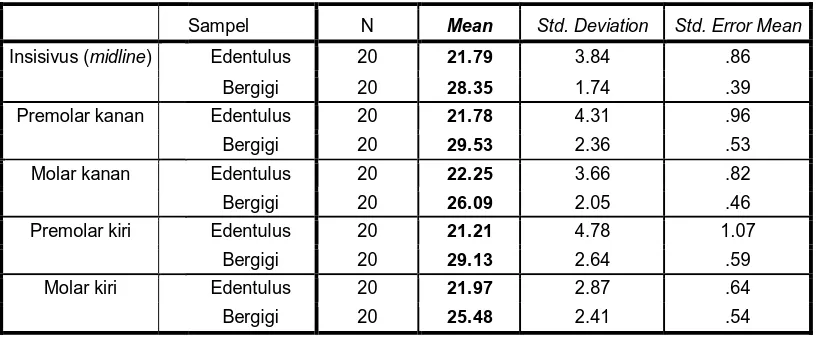 Tabel 1. Hasil pengukuran nilai rata-rata ketinggian mandibular alveolar ridge pada titik  insisivus,  titik premolar  kanan,  titik  molar  kanan,  titik premolar kiri dan titik molar kiri  