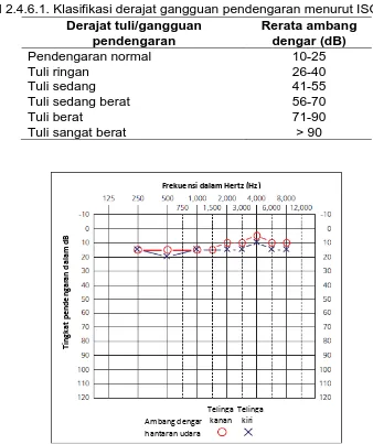 Tabel 2.4.6.1. Klasifikasi derajat gangguan pendengaran menurut ISO40 Derajat tuli/gangguan Rerata ambang 