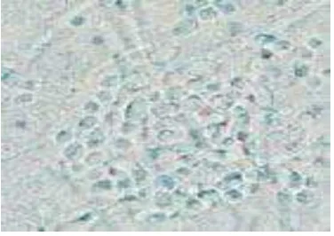 Gambar 2.1  Gambaran mikrokopis Candida, tampak adanya budding yeasts dengan hypa dan pseudohypa