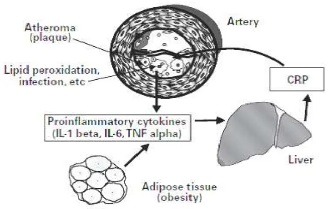 Gambar 2. Skema yang menggambarkan peran highly sensitivity c-reactive protein pada inflamasi dan aterosklerosis
