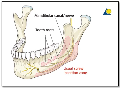 Gambar 1. Kanalis mandibularis dan saluranarteri  dan nervus10  