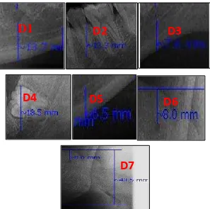 Gambar 5. Pengukuran kanalis mandibularis sebelah kiri dari D1 – D7 pada penelitian (dokumen pribadi) 