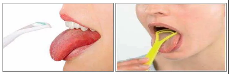 Gambar 2.7  Pembersihan lidah dengan alat pembersih lidah (Harris dan Garcia-Godoy, 2004)