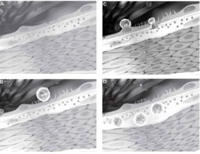 Gambar 2.1. Proses pembentukan foam cell (A) Artery normal, meliputi lumen yang 