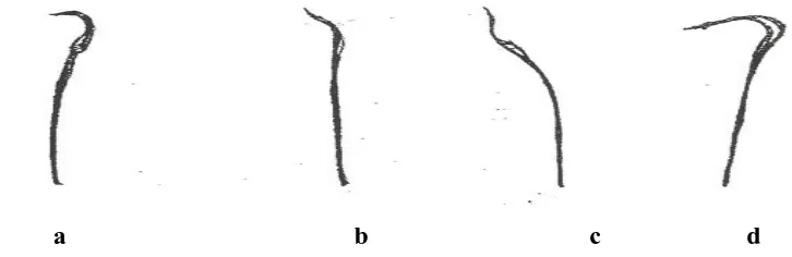 Gambar 2.4   Bentuk-bentuk sperma pada tikus. a. bentuk sperma normal; 