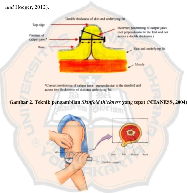 Gambar 2. Teknik pengambilan Skinfold thickness yang tepat (NHANESS, 2004) 