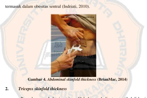 Gambar 4. Abdominal skinfold thickness (BrianMac, 2014)  2.  Tricepss skinfold thickness 