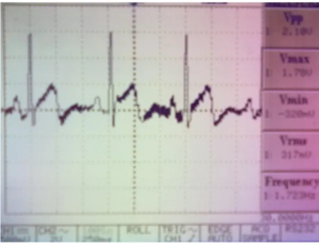 Gambar 12. Data serial yang diterima dari mikrokontroler hasil ADC sinyal EKG. Gambar 11