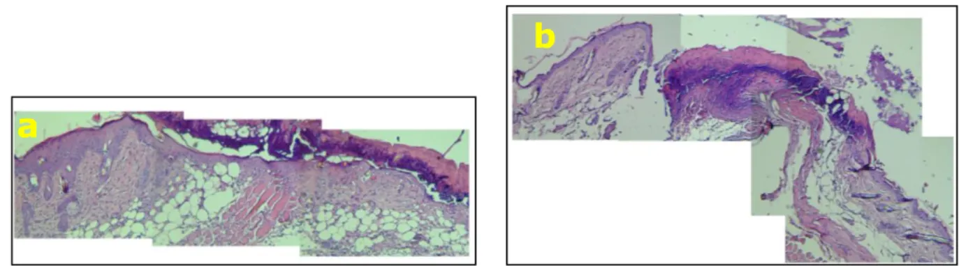 Gambar 4. Foto preparat hasil uji histopatologi: BinPirox (a); Pirox (b) 