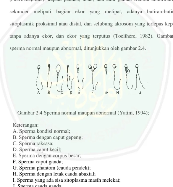 Gambar 2.4 Sperma normal maupun abnormal (Yatim, 1994); 