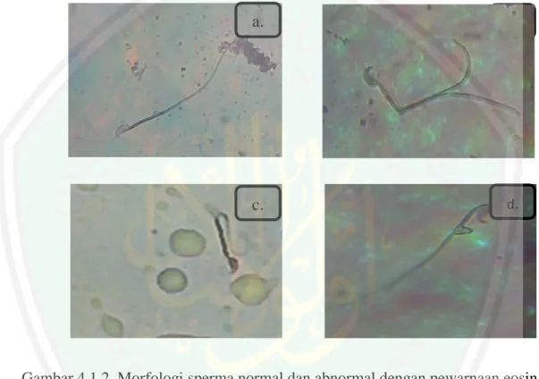 Gambar 4.1.2. Morfologi sperma normal dan abnormal dengan pewarnaan eosin  nigrosin pada perbesaran 400x 