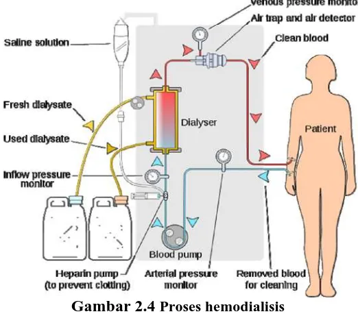 Gambar 2.4 Proses hemodialisis 